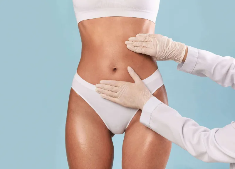 CoolSculpting body contouring