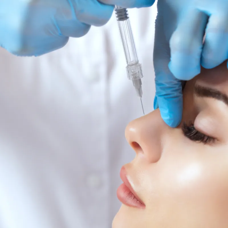 Facial filler treatment