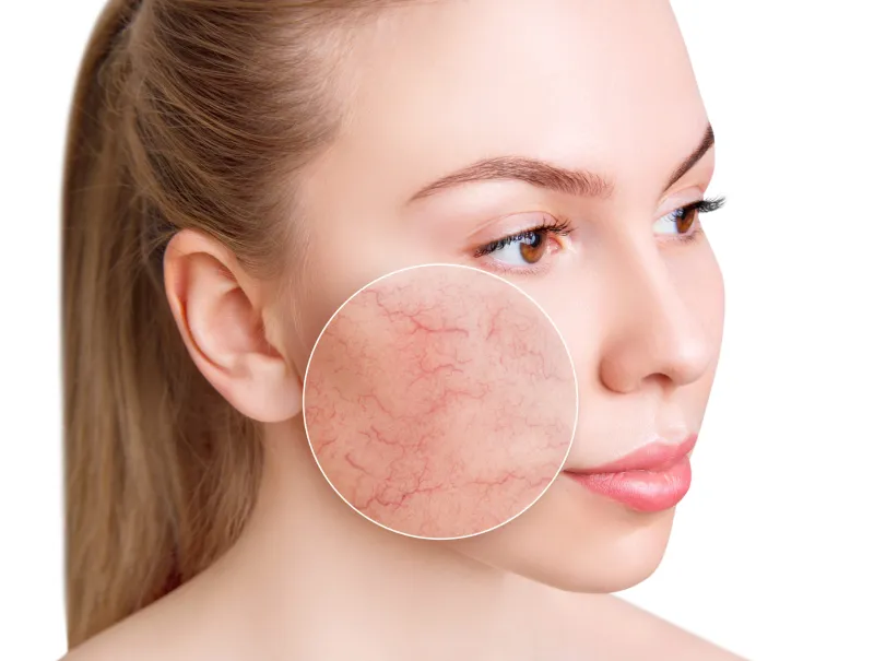 Skin concern close-up